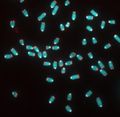 분열 직전 생쥐 피부세포의 염색체(푸른색)와 텔로미어 말단(붉은색).
